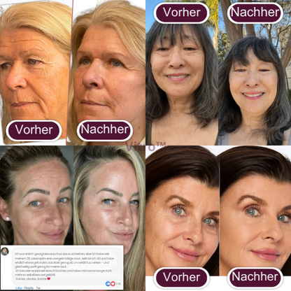 Kollagen-Calcium Anti-Aging Balsam