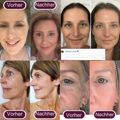 Kollagen-Calcium Anti-Aging Balsam